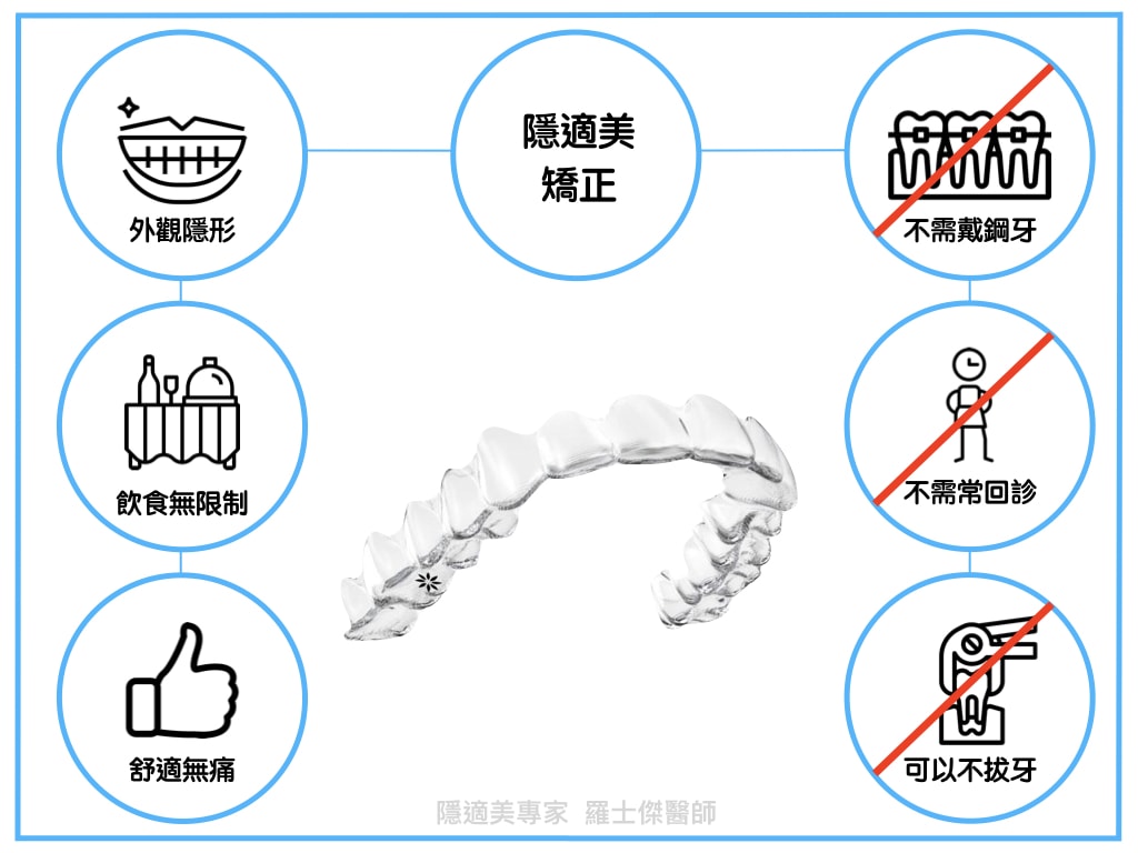 隱適美數位隱形矯正-羅士傑